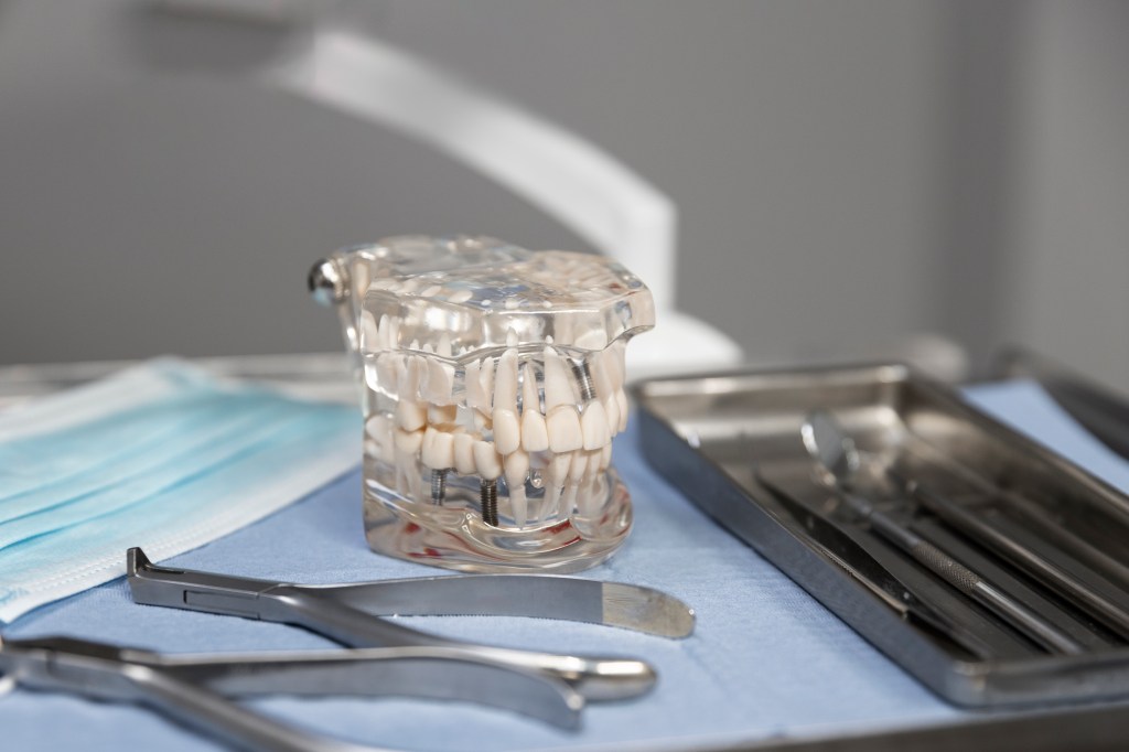 All-on-4 Dental Implants vs Traditional Dental Implants